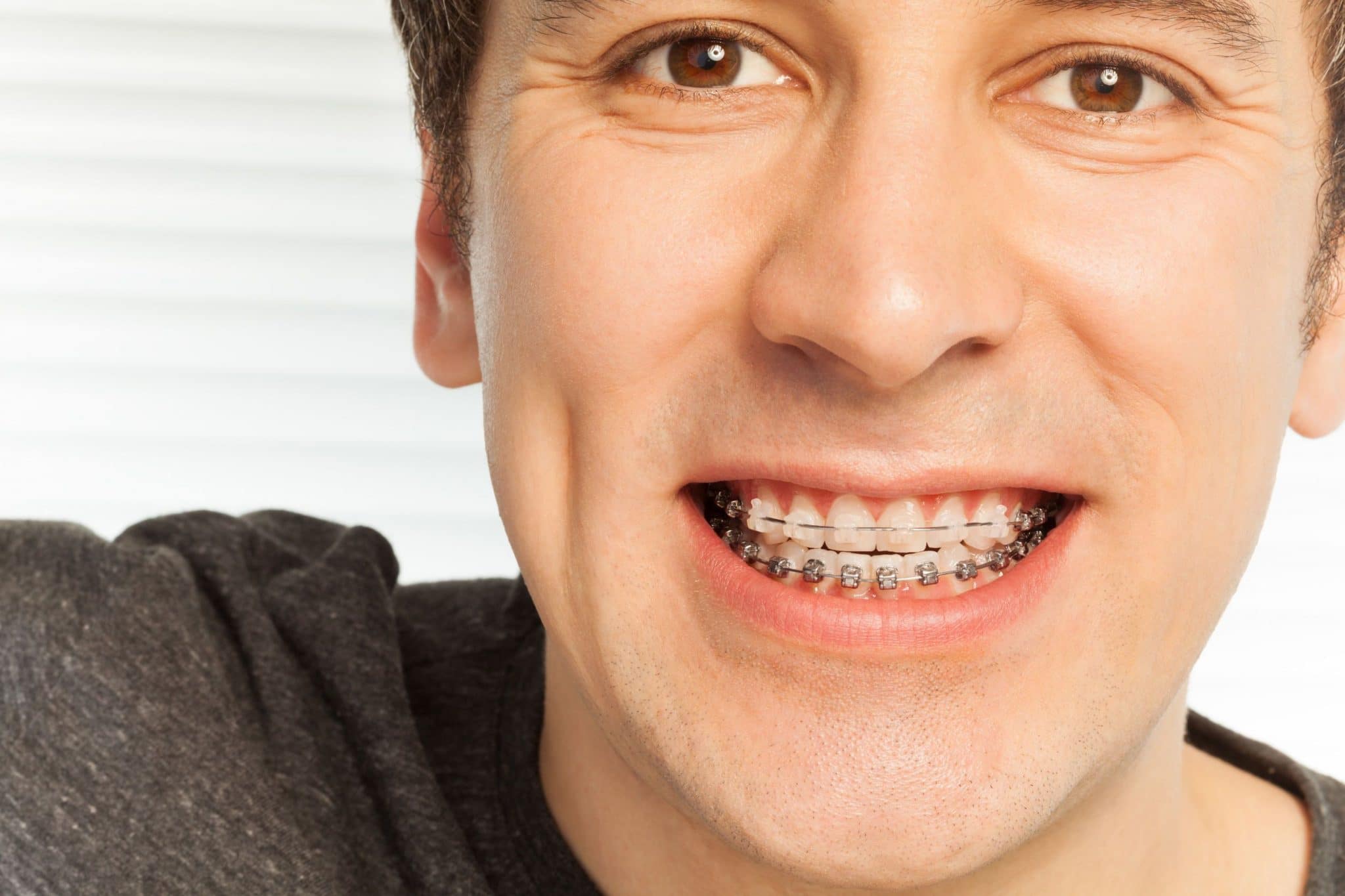 What Are the Advantages of Orthodontic Treatment?